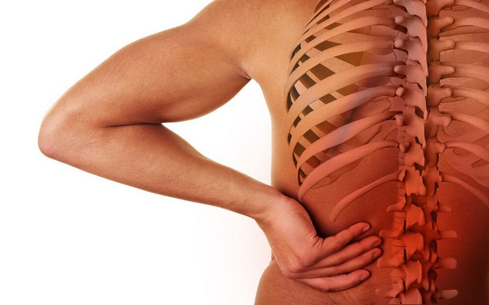 Mal di schiena dovuto all'osteocondrosi