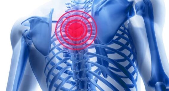 Trattamento dell'osteocondrosi della colonna vertebrale toracica
