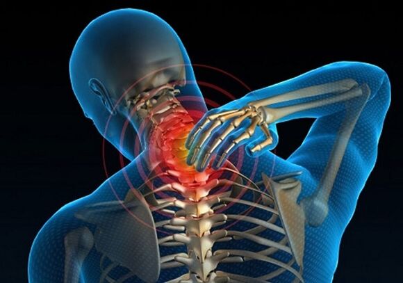 Dolore al collo dovuto all'osteocondrosi
